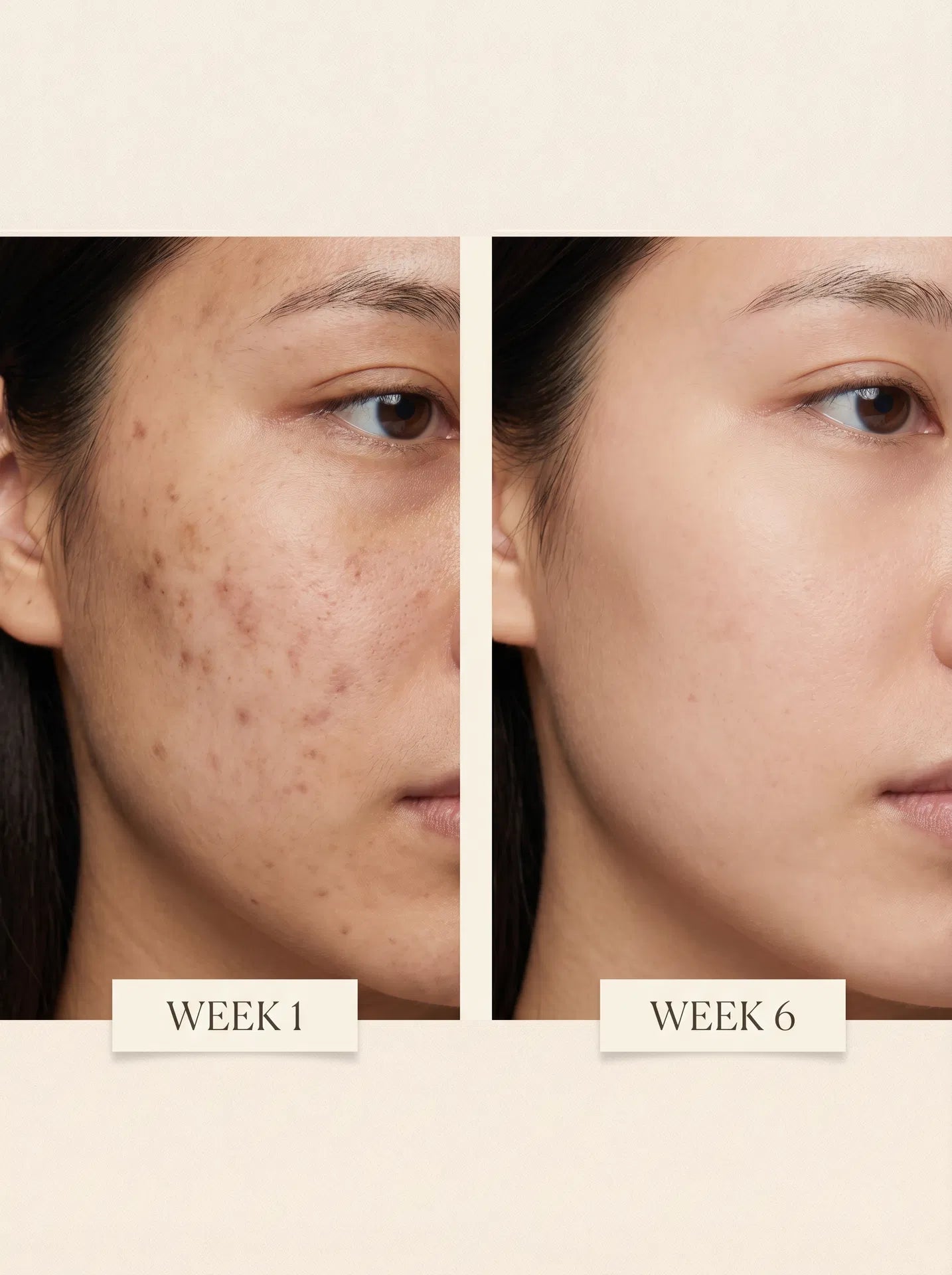 Before and after using Alvani Dark Spot Corrector Serum